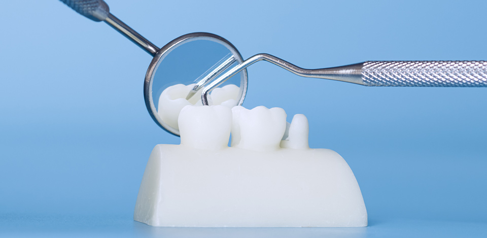 Dental Procedures