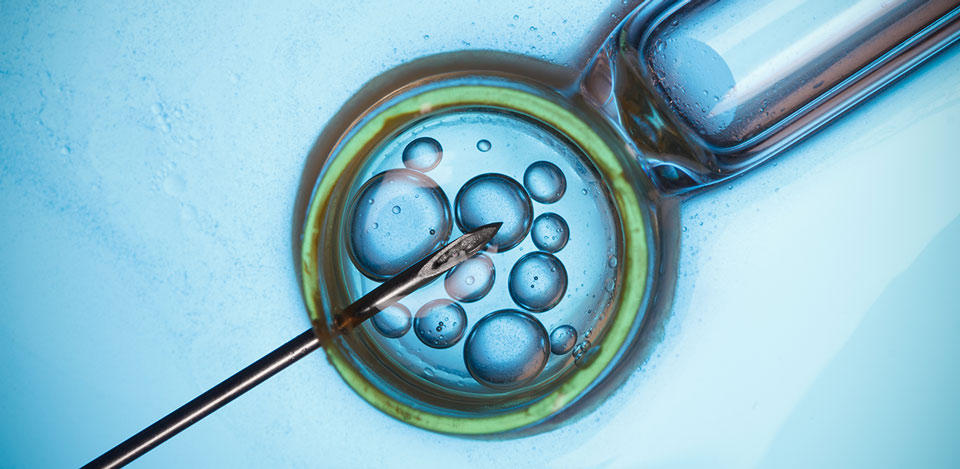 Infertility & IVF